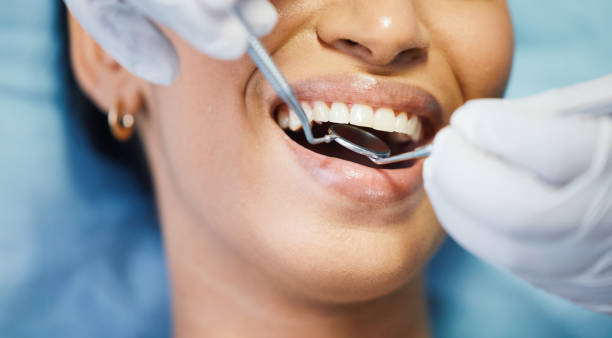 Best Emergency Dental Care for Broken or Chipped Teeth in Johnston, SC
