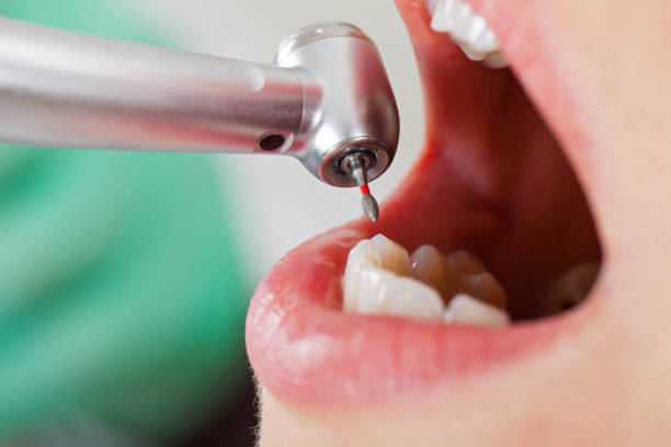 Best Pediatric Emergency Dentist in Johnston, SC